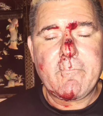 File:Brian Leake after bike crash.png